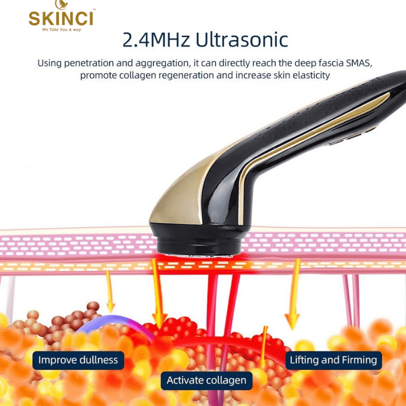 Intense Pulsed Light (IPL) Therapy